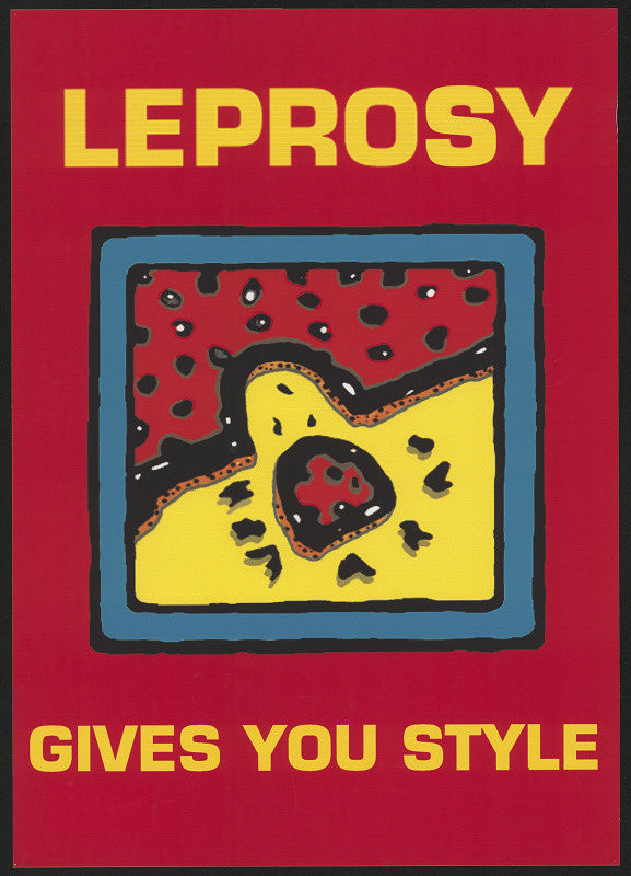 Michal Estrada – Leprosy gives you style