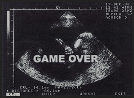 Lukáš Ferenčák – Game over 