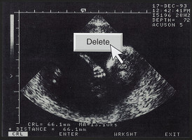 Lukáš Ferenčák – DELETE 