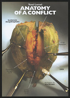 Yossi Lemel – Anatomy of a Conflict 