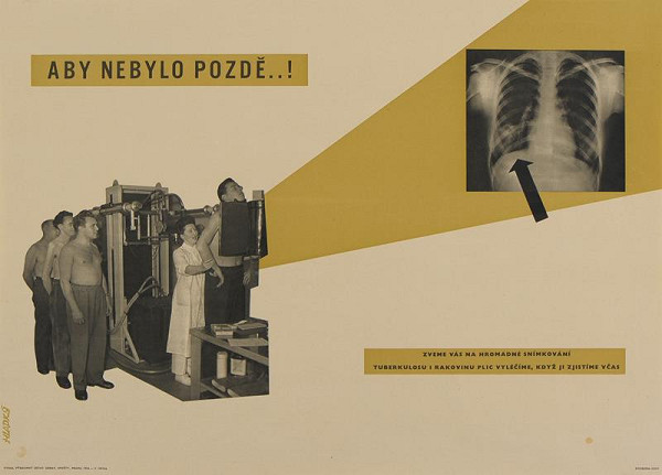 Hladký – Aby nebylo pozdě - hromadné snímkování proti TBC a rakovině 