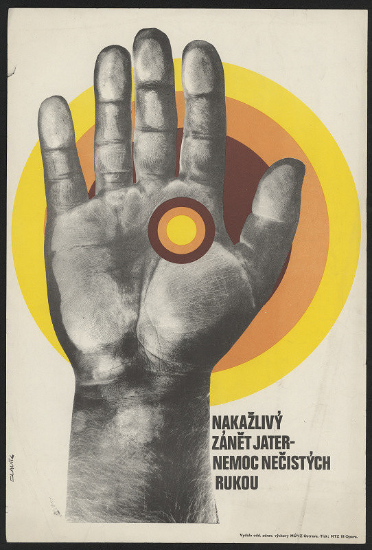 Karel Slavík – Nakažlitý zánět jater - nemoc nečistých rukou 