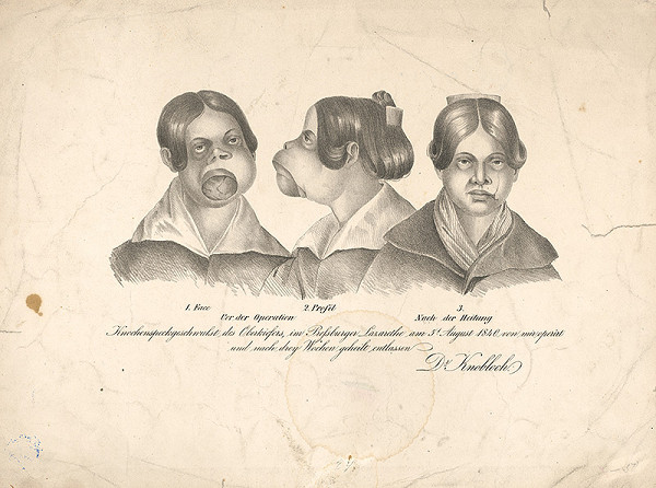 Stredoeurópsky grafik z 19. storočia – Operácia dr.Knoblocha 